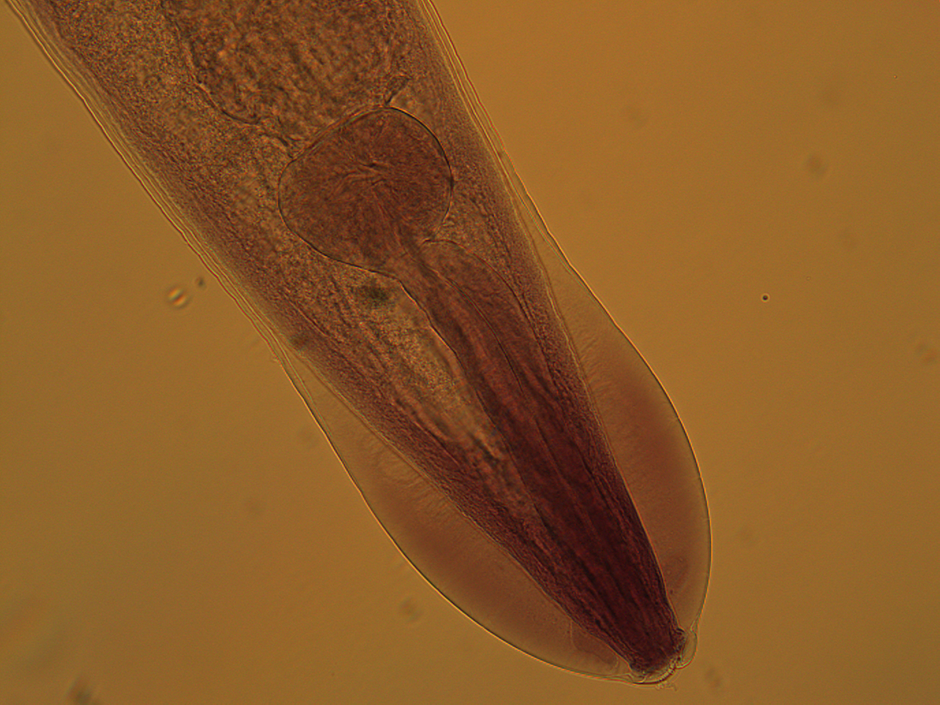 Anterior end of the rodent pinworm, Syphacia muris