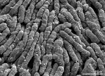 Scanning electron micrograph of Streptobacillus moniliformis 9901T