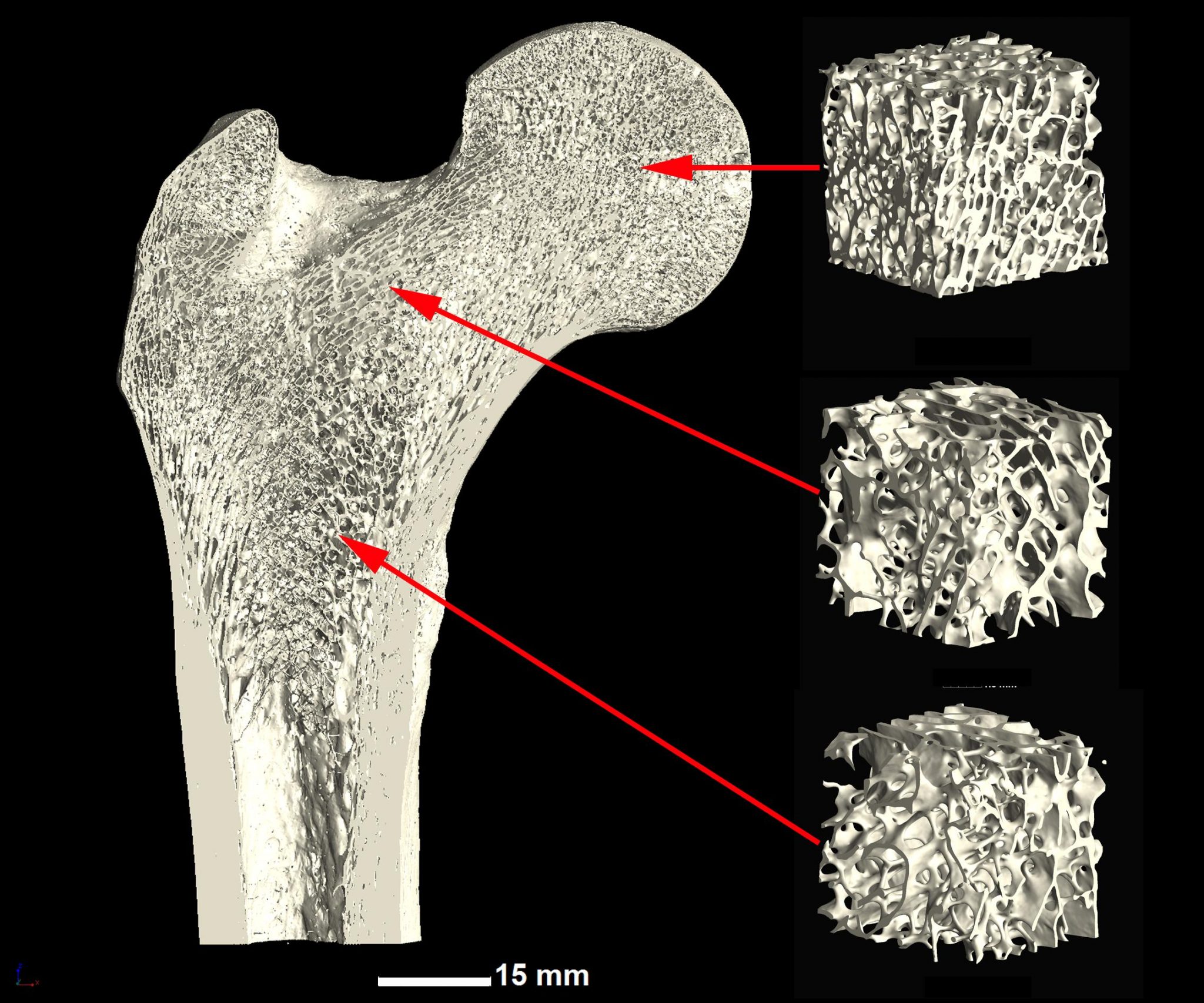 Video bone. Bone structure. Trabecular Bone. Cortical ND trabecular Bones. Texture Segmentation.